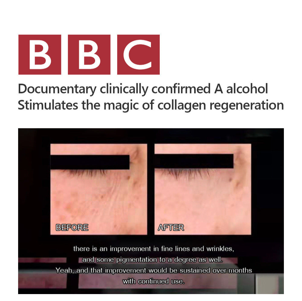 Retinol Tightening Plastic Activating Cream