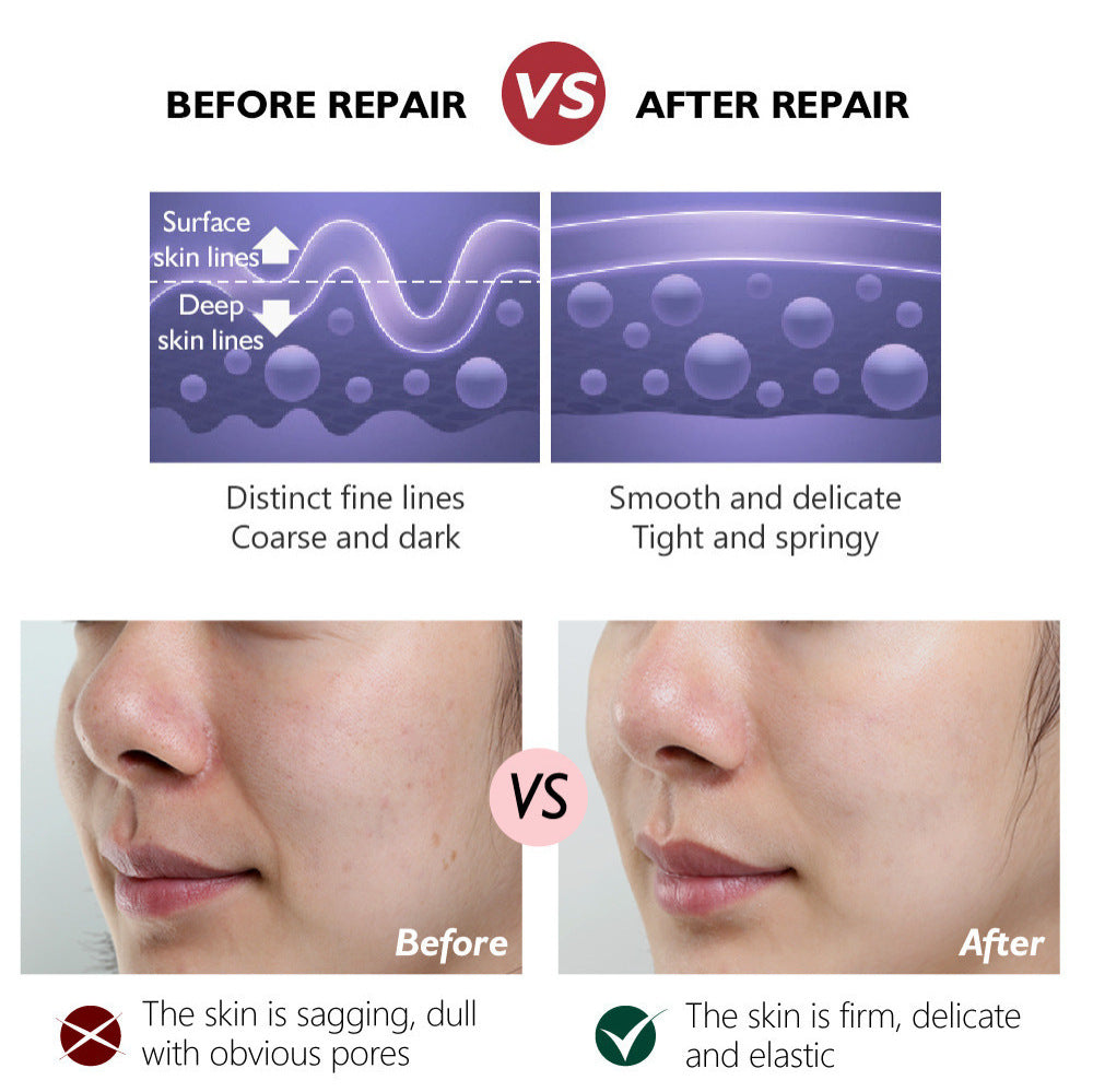 Retinol Tightening Plastic Activating Cream