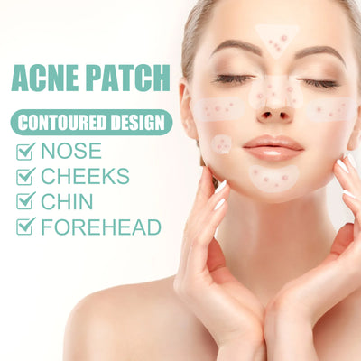 Acne Removing Patch To Fade And Remove Acne